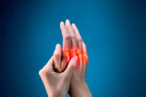 arthritis-pain-management